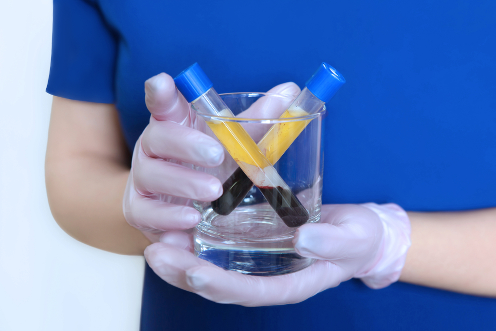 Is all PRP the same?