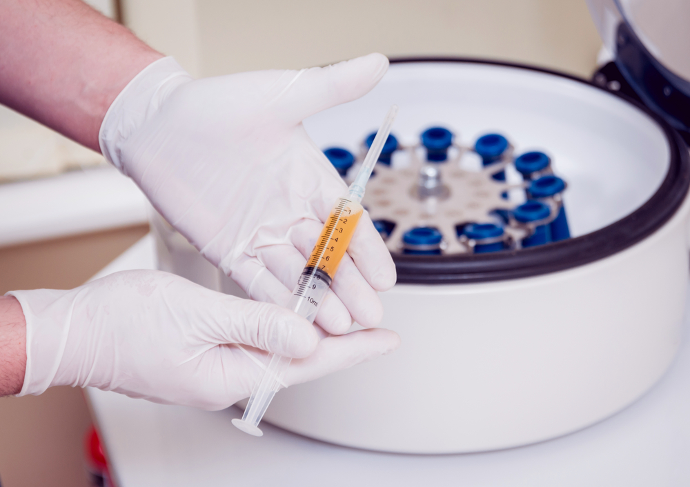 Effectiveness of Platelet Rich Plasma