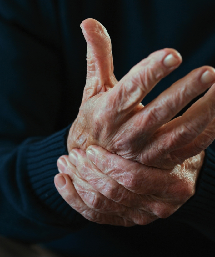 Joint Health Rheumatoid Arthritis