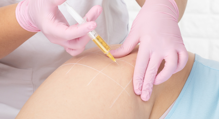 Step 3 Treatment Phase (Regenerative Therapies)